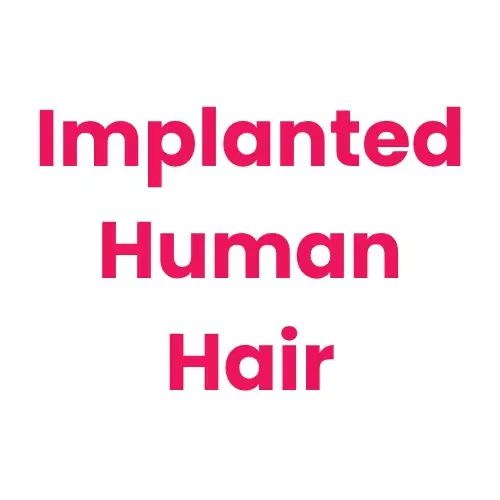 Cheveux naturels implantés