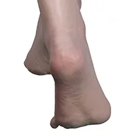 Pieds renforcés sans boulons