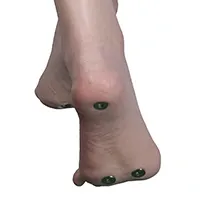 Boulons sous les pieds
