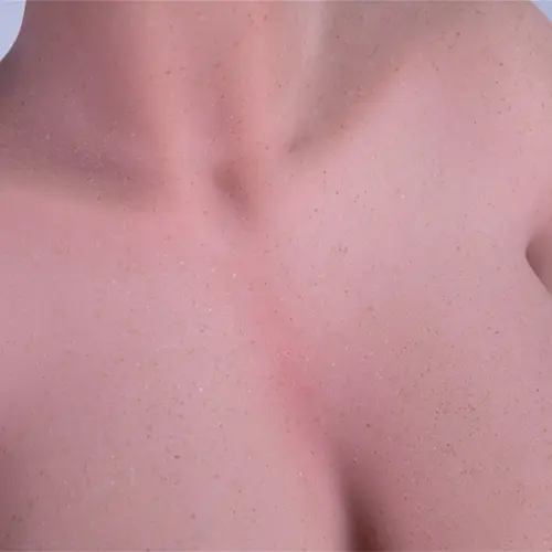 Taches de rousseur du corps